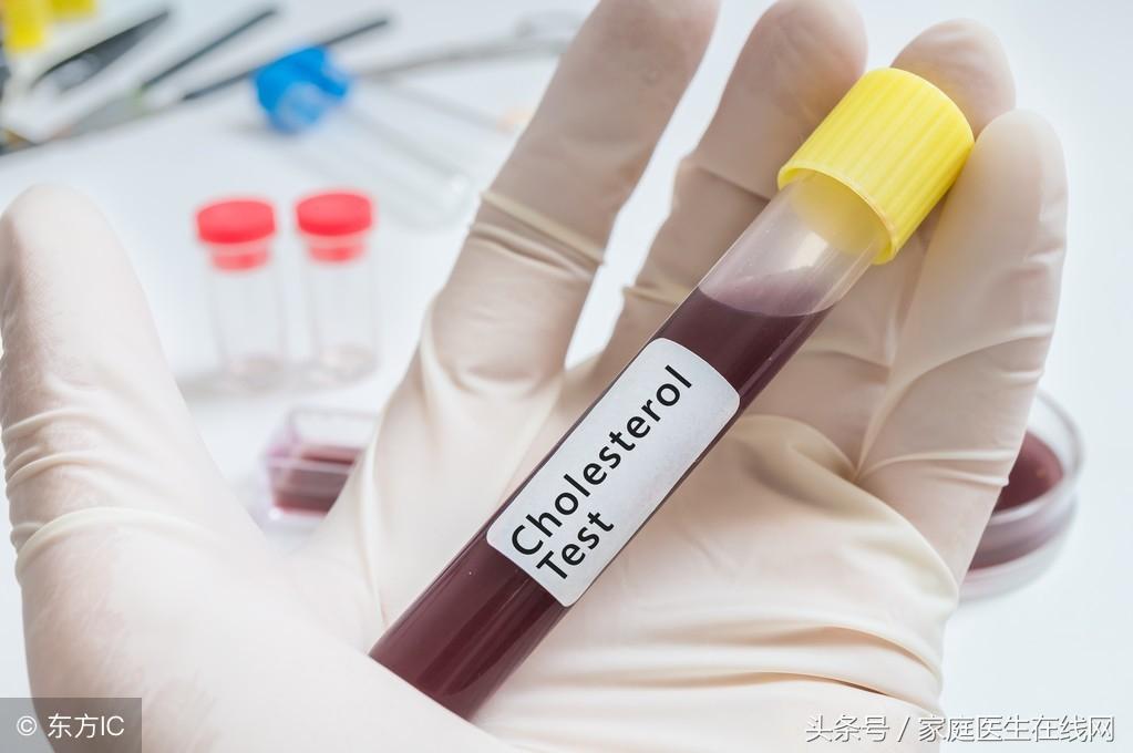 糖尿病的成因，深度解析其背后的原因，深度解析糖尿病成因，揭示背后原因真相