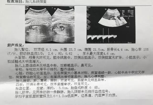 殲-11B重型戰(zhàn)斗機(jī)，卓越性能與先進(jìn)技術(shù)的完美結(jié)合，殲-11B重型戰(zhàn)斗機(jī)，卓越性能與技術(shù)的巔峰融合