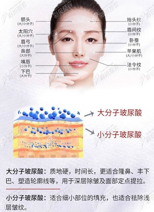 玻尿酸的作用與功效，深入了解玻尿酸的奧秘，玻尿酸的作用與功效揭秘，深入了解玻尿酸的神奇之處