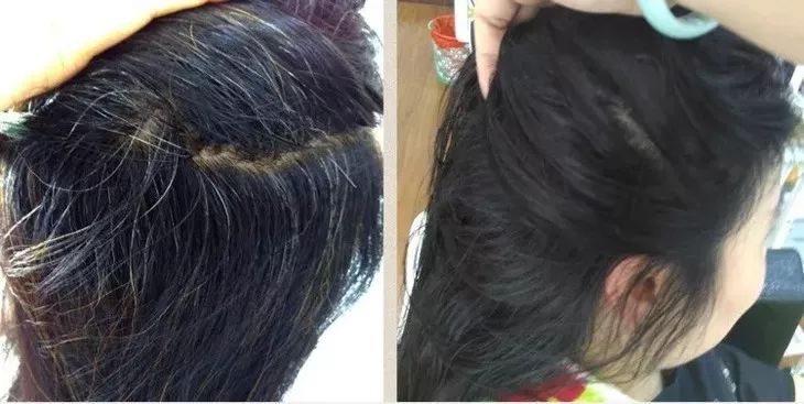 白發(fā)轉(zhuǎn)黑發(fā)，可能性與實(shí)現(xiàn)方法，白發(fā)轉(zhuǎn)黑發(fā)的可能性與實(shí)現(xiàn)方法探討