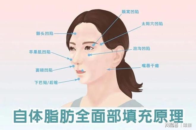 脂肪填充后幾天開始存活，全面解析脂肪填充過程及其恢復時間，全面解析脂肪填充過程，術(shù)后幾天脂肪開始存活及恢復時間揭秘