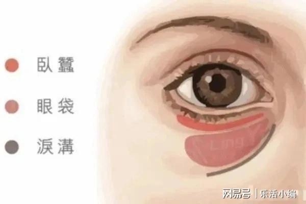 眼袋切除手術(shù)費用詳解，價格因素與如何選擇合適的手術(shù)方案，眼袋切除手術(shù)費用解析，了解價格因素與選擇最佳手術(shù)方案