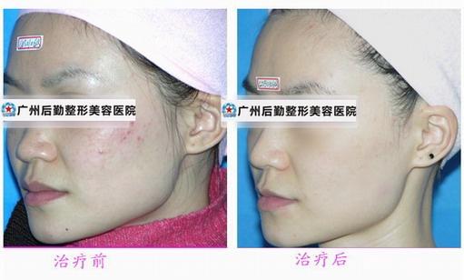 揭秘祛斑秘籍，如何有效祛斑？，揭秘祛斑秘籍，有效祛斑方法與技巧探討