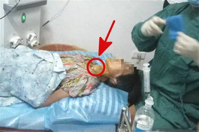 甲狀腺結(jié)節(jié)4A持續(xù)二十年，深入了解與管理，甲狀腺結(jié)節(jié)二十年持續(xù)觀察與管理策略